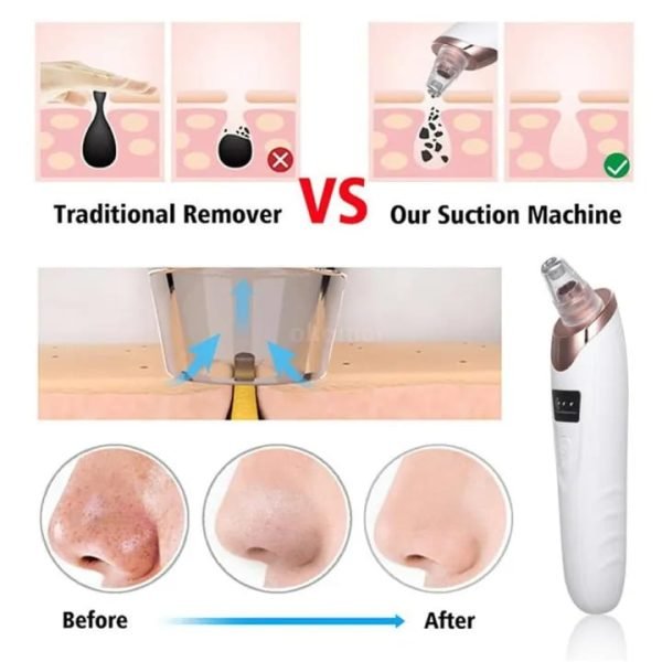 Face Vacuum Suction Blackhead Remover Pore Cleaner | Electric Deep Cleansing Tool For Nose & Face - Unistyles store