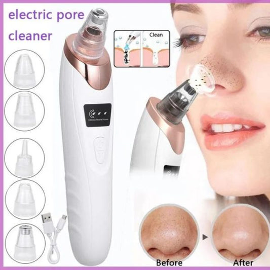 Face Vacuum Suction Blackhead Remover Pore Cleaner | Electric Deep Cleansing Tool For Nose & Face - Unistyles store